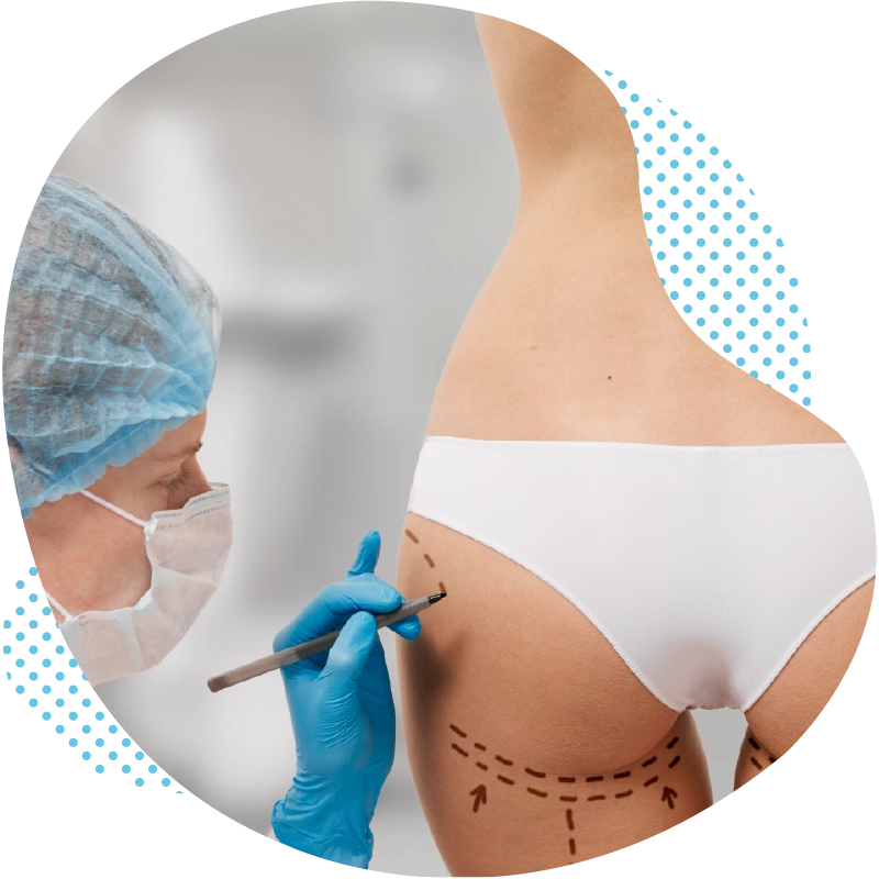 BBL Turkey - All Procedures